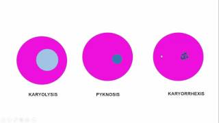 MORPHOLOGY OF CELL INJURY: REVERSIBLE 