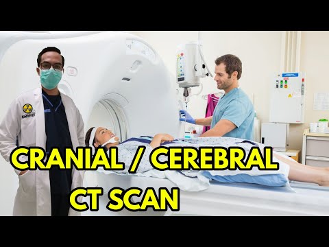 Video: Cranial CT Scan: Účel, Postup A Preventívne Opatrenia