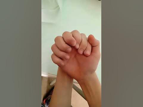 девять пальцев на одной руке - YouTube