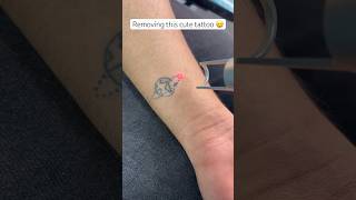 Removing This Cute Tattoo