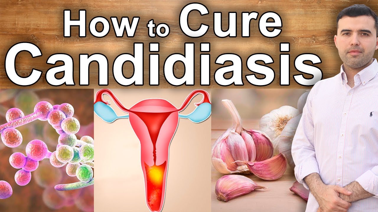 Natural Treatment 100 Effective Against Candidiasis How To Cure