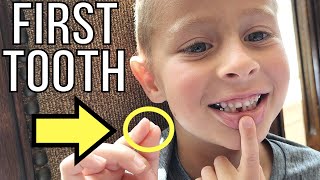 HE PULLED OUT HIS FIRST TOOTH! 🦷