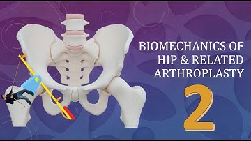 Hip Joint Biomechanics and arthroplasty: Simplified Basics Part 2 of 3