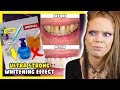 The TRUTH about 'INSTANT Whitening TOOTHPASTE'