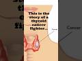 Story of thyroid cancer survivor || iodine therapy || NuclearMedicine || must watch #thyroiddisorder