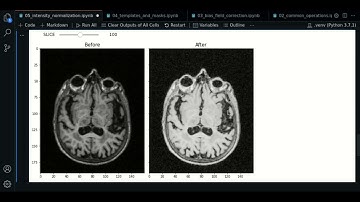 5.0 - Histogram Matching | SimpleITK - Course MRI preprocessing with Python