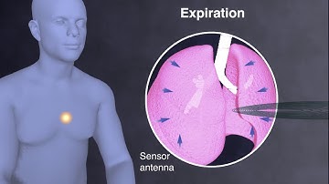 Wireless Body Area Networks (WBANs) - Tsouri Lab