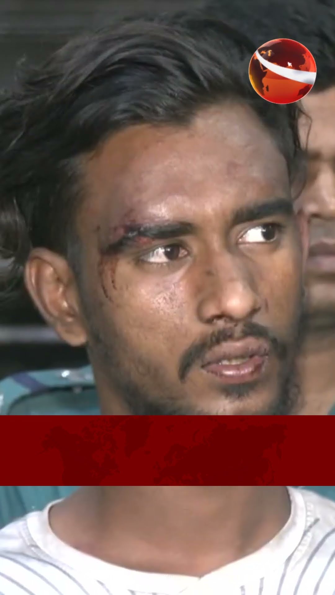রাজধানীর উত্তরায় দম্পতিকে কু*পি*য়ে জখম  আটক ২ #channel24 #news #channel24_news