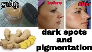 DIY ginger cream/pigmentation/dark spots/Tamil.