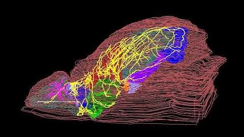 Single-cell visualization of a mitral cell in the mouse brain