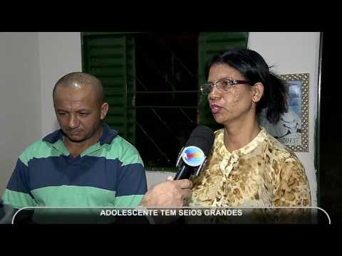 Vídeo: Seios Gigantes Quase Tiraram A Vida De Uma Jovem Peruana - Visão Alternativa