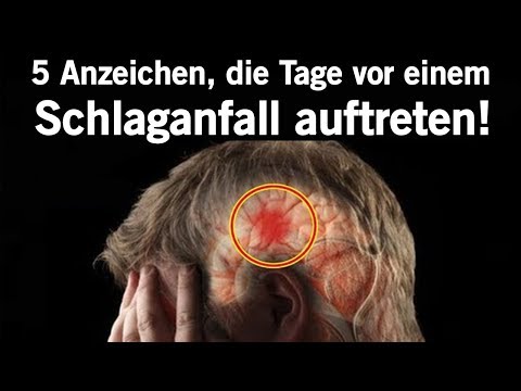 5 Anzeichen, die Tage vor einem Schlaganfall auftreten können!