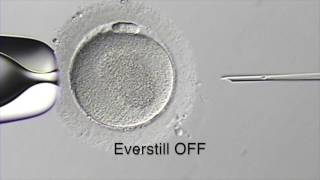 Everstill App Note