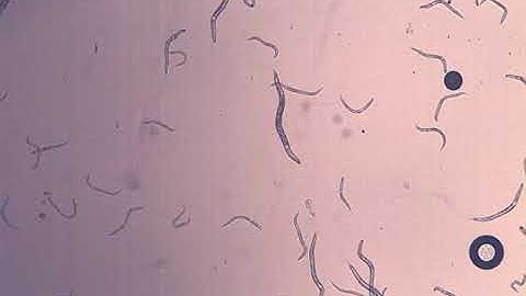 C. elegans rol-6 movement