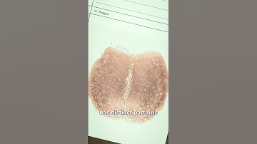 Using A Tongue Print To Solve Crimes 🤔