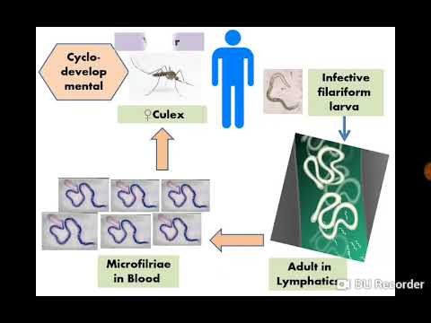 19  Wuchereria bancrofti - Dr Noha Madbouly