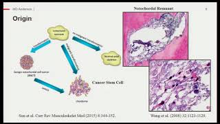 Future horizons: Basic science research: 2017 Chordoma Community Conference screenshot 4