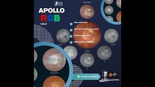 Apollo By Microclear Ultra-Widefield Retinal Imaging Like Never Before