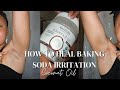 How To Heal Baking Soda Underarm Burn ! EuniyceMari