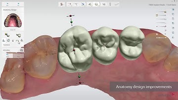 3DBioCAD - 3Shape Implant Studio 2017  What