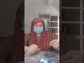 lab work metal copen #trending #shorts #dentallab