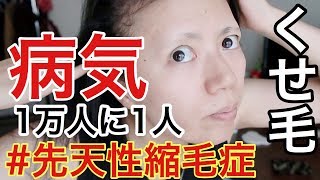 ご報告 強いくせ毛に病名がありました 先天性縮毛症 Youtube