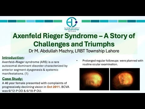 Axenfeld Rieger Syndrome – Challenges and Triumphs-The Best Poster ...