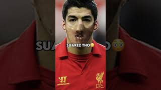 Other Players With A Mask Vs Suarez