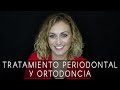 La sonrisa de Cristina: tratamiento periodontal y ortodoncia