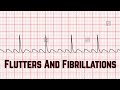 Flutters and Fibrillations - CRASH! Medical Review Series