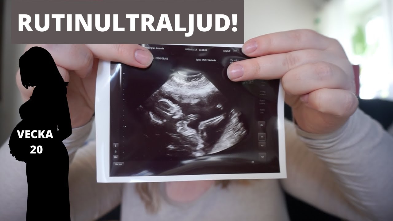 ULTRALJUD | Gravid vecka 20