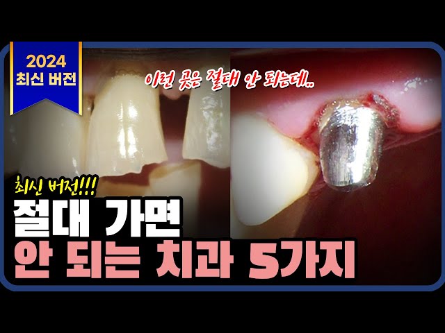 ()피해야 할 치과 TOP5 ㅣ 좋은 치과 가는 방법 알려드립니다.