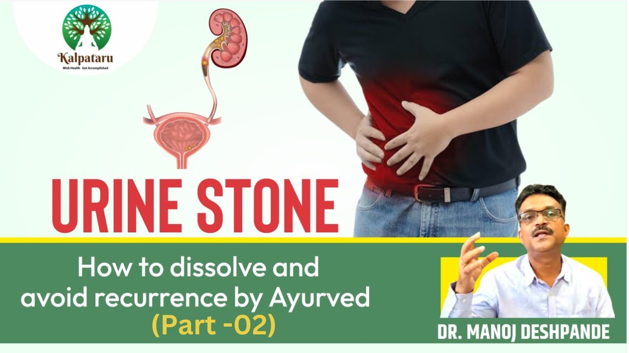 Urine Stone (मुतखडा) How to avoid recurrence by Ayurved(Part - 2 ...