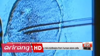 International research team grows mini midbrains from human stem cells