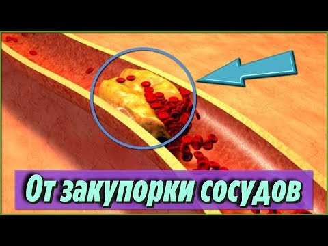 Самые ЛУЧШИЕ ПРОДУКТЫ которые предотвращают ЗАКУПОРКУ СОСУДОВ и АРТЕРИЙ Полезные советы для ЗДОРОВЬЯ