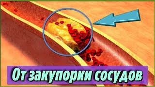 Самые Лучшие Продукты Которые Предотвращают Закупорку Сосудов И Артерий Полезные Советы Для Здоровья