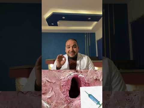 وخز ابرة في الجلد