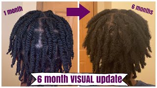 6 Month VISUAL Loc Update On 4C Starter Locs | Naomi Onlae 6 Month VISUAL Loc Update On 4C Starter Locs | Naomi Onlae