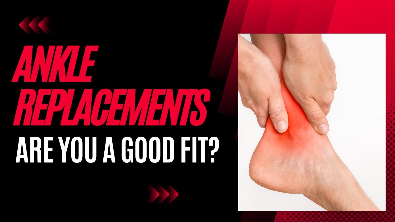 Should You Get a Total Ankle Replacement? Foot & Ankle Surgeons Discuss