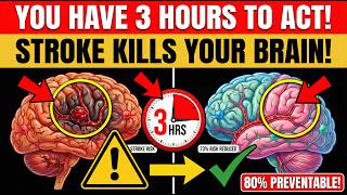 STROKE: You Have 3 Hours to Save Your Brain (Proven Protocol)