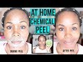 HOW TO Make a NATURAL Chemical Peel AT HOME | ERASE ACNE, WRINKLES & DARK SPOTS