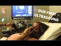 Our first ultrasound  buying a new car  sarati  jesse