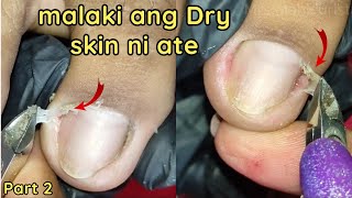 Vlog 1026|Dry Skin/Ingrown Removal| PEDICURE 926