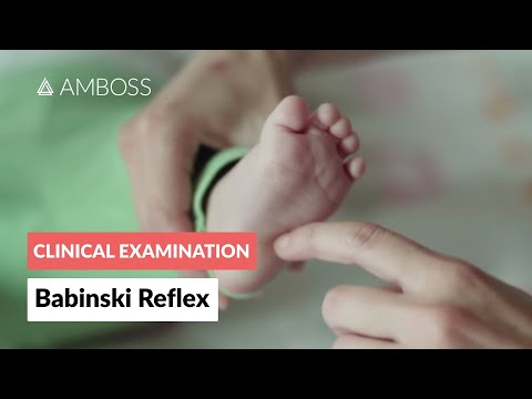 Babinski Reflex in Infants - Clinical Examination