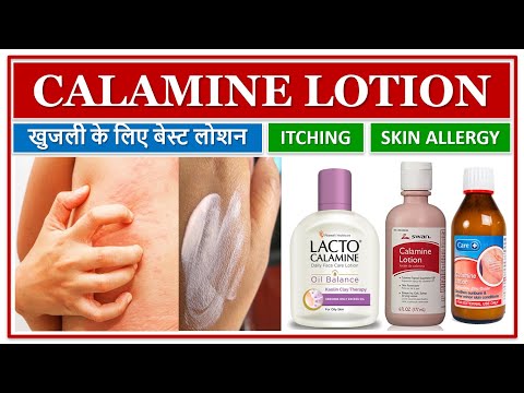 Question: Is It Safe To Put Calamine Lotion On A Dog - Bikehike