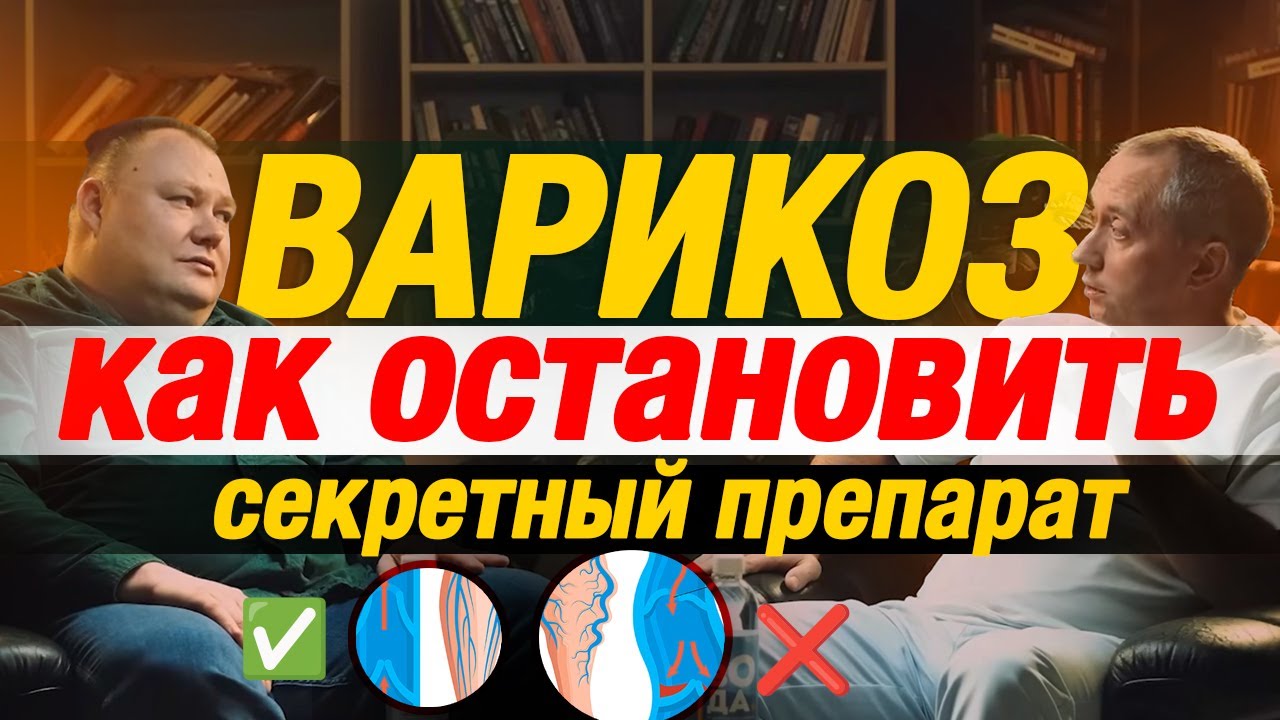Что делать с ВАРИКОЗОМ отвечает хирург-флеболог Сергей Васильевич Чубченко ! Доктор Шишонин А.Ю