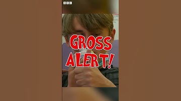 Boy Gets His PUS-FILLED Spider Bite POPPED! 🕷️🤮 | Operation Ouch! #shorts