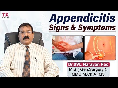 How To Diagnose Appendicitis || Appendix Pain Symptoms || Dr Dvl Narayan Rao || Tx Hospitals