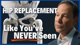 Total Hip Replacement: One Step Can Change Your Life FOREVER