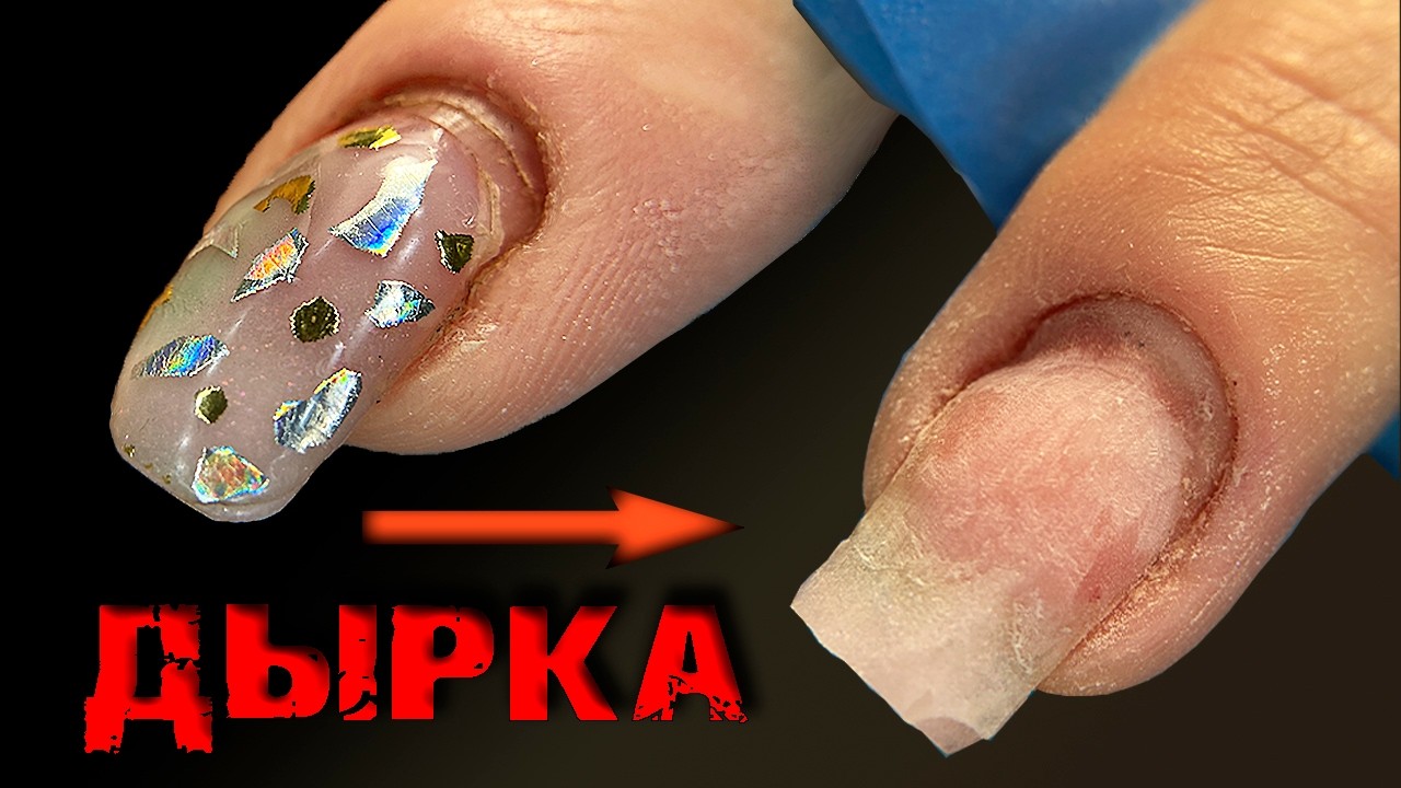 Что с НОГТЯМИ?!😰Ужасные ПЕРЕПИЛЫ, ДЫРКИ.🤔 КТО ВИНОВАТ?ИСПОРТИЛИ НОГТИ.Что Делать.мк.ТРЕШ МАНИКЮР